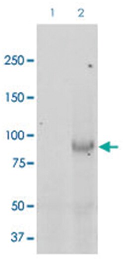SCNN1B, Rabbit, APC, Polyclonal Antibody, Abnova 100 &mu;g | Buy Online | Abnova Corporation | Fisher Scientific
