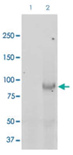 SCNN1B, Rabbit, Biotin, Polyclonal Antibody, Abnova 100 &mu;g | Buy Online | Abnova Corporation | Fisher Scientific