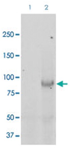 SCNN1B, Rabbit, FITC, Polyclonal Antibody, Abnova 100 &mu;g | Buy Online | Abnova Corporation | Fisher Scientific