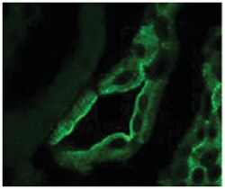 SCNN1B, Rabbit, FITC, Polyclonal Antibody, Abnova 100 &mu;g | Buy Online | Abnova Corporation | Fisher Scientific
