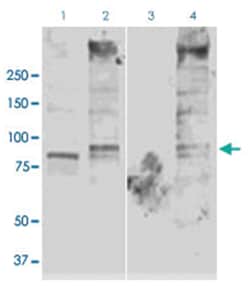 Scnn1g, Rabbit, APC, Polyclonal Antibody, Abnova 100 &mu;g | Buy Online | Abnova Corporation | Fisher Scientific