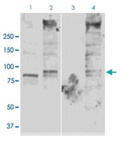 Scnn1g, Rabbit, HRP, Polyclonal Antibody, Abnova 100 &mu;g | Buy Online | Abnova Corporation | Fisher Scientific