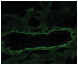 Scnn1g, Rabbit, HRP, Polyclonal Antibody, Abnova 100 &mu;g | Buy Online | Abnova Corporation | Fisher Scientific