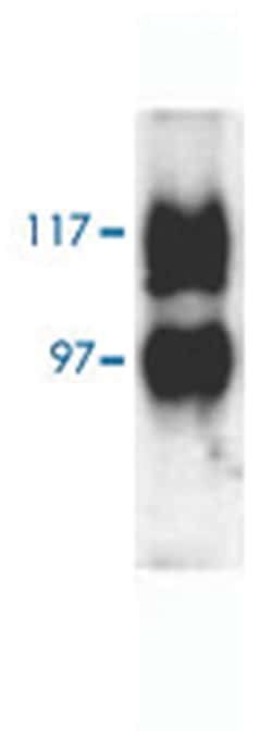 Slc14a2, Rabbit, HRP, Polyclonal Antibody, Abnova 100 &mu;g | Buy Online | Abnova Corporation | Fisher Scientific