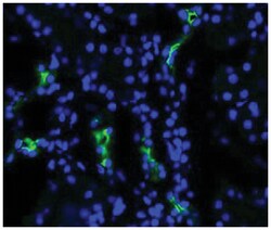 Aqp2, Rabbit, Biotin, Polyclonal Antibody, Abnova 100 &mu;g | Buy Online | Abnova Corporation | Fisher Scientific