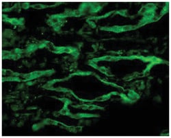 Aqp4, Rabbit, FITC, Polyclonal Antibody, Abnova 100 &mu;g | Buy Online | Abnova Corporation | Fisher Scientific