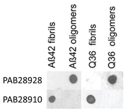 APP oligomers, Rabbit, PerCP, Polyclonal Antibody, Abnova 100 &mu;L | Buy Online | Abnova Corporation | Fisher Scientific
