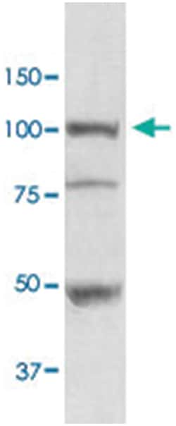 HSP90B1, Rabbit, ATTO390, Polyclonal Antibody, Abnova 100&mu;g; ATTO390:Antibodies,