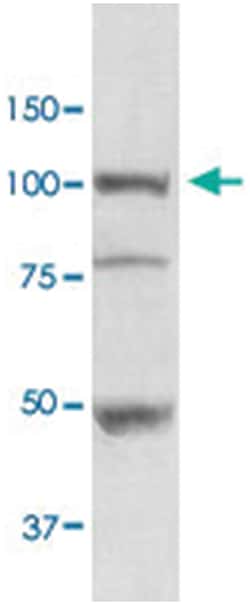 HSP90B1, Rabbit, ATTO488, Polyclonal Antibody, Abnova 100&mu;g; ATTO488:Antibodies,