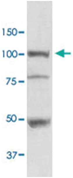 HSP90B1, Rabbit, FITC, Polyclonal Antibody, Abnova 100 &mu;g | Buy Online | Abnova Corporation | Fisher Scientific