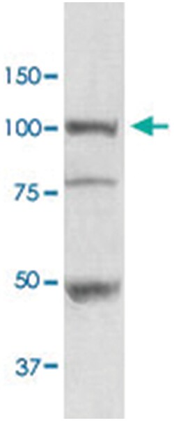 HSP90B1, Rabbit, HRP, Polyclonal Antibody, Abnova 100&mu;g; HRP:Antibodies,