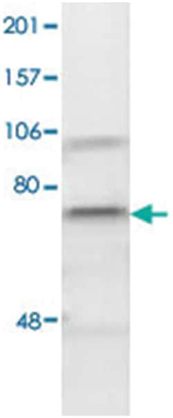 KDEL, Rabbit, HRP, Polyclonal Antibody, Abnova 200 &mu;g | Buy Online | Abnova Corporation | Fisher Scientific