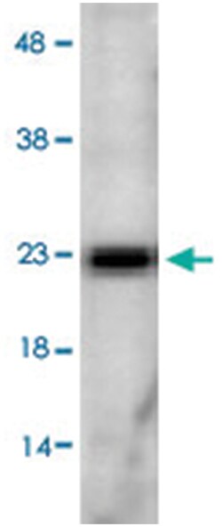 Sod2, Rabbit, ATTO390, Polyclonal Antibody, Abnova 100 &mu;g | Buy Online | Abnova Corporation | Fisher Scientific
