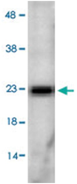 Sod2, Rabbit, ATTO488, Polyclonal Antibody, Abnova 100 &mu;g | Buy Online | Abnova Corporation | Fisher Scientific