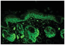 Sod2, Rabbit, HRP, Polyclonal Antibody, Abnova 100 &mu;g | Buy Online | Abnova Corporation | Fisher Scientific