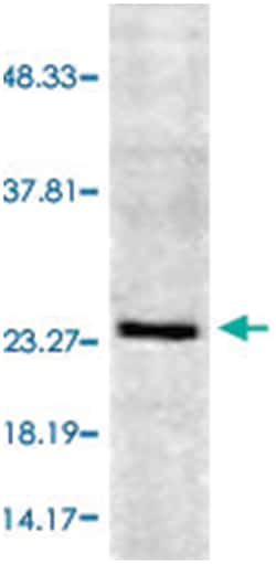 RAB5A, Rabbit, ATTO594, Polyclonal Antibody, Abnova 100 &mu;g | Buy Online | Abnova Corporation | Fisher Scientific