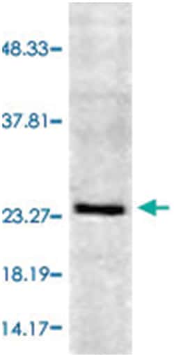 RAB5A, Rabbit, APC, Polyclonal Antibody, Abnova 100 &mu;g | Buy Online | Abnova Corporation | Fisher Scientific