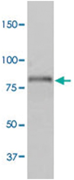 SLC9A3, Rabbit, FITC, Polyclonal Antibody, Abnova 100&mu;g; FITC:Antibodies,