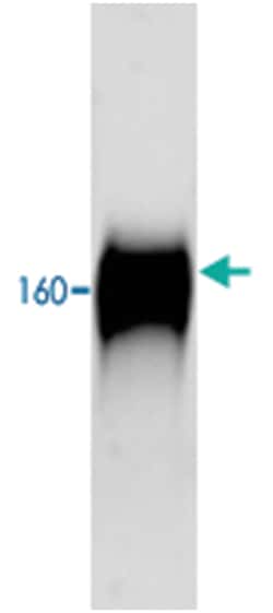 Slc12a1, Rabbit, ATTO390, Polyclonal Antibody, Abnova 100 &mu;g | Buy Online | Abnova Corporation | Fisher Scientific