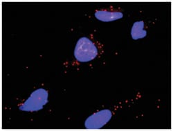anti-IKBKB, CLTC Protein Protein Interaction Antibody Pair, Abnova™