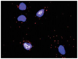 anti-OSM, COL4A6 Protein Protein Interaction Antibody Pair, Abnova™