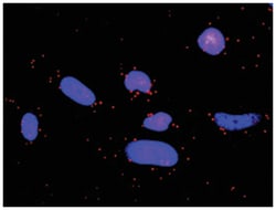 anti-STAT5A, CTLA4 Protein Protein Interaction Antibody Pair, Abnova™