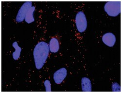 Abnova Corporation&nbsp;anti-ERBB3 & ERBB2 Protein Protein Interaction Antibody Pair, Abnova&trade;