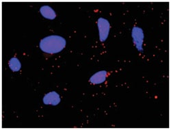 anti-FGA, F2 Protein Protein Interaction Antibody Pair, Abnova™