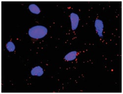 anti-FGA, F2 Protein Protein Interaction Antibody Pair, Abnova&trade; 1 set, Unlabeled 