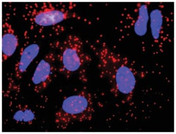 anti-CALR, F8 Protein Protein Interaction Antibody Pair, Abnova 1 set,