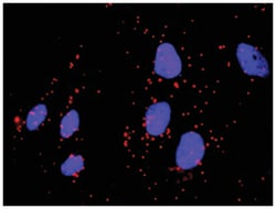 anti-SYK, FCGR1A Protein Protein Interaction Antibody Pair, Abnova&trade;