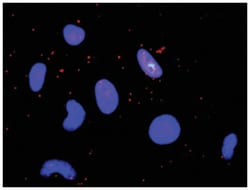 Abnova Corporation&nbsp;anti-FGFR1, CREBBP Protein Protein Interaction Antibody Pair, Abnova&trade;