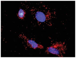Abnova Corporation anti-IGF1R, MDM2 Protein Protein Interaction Antibody Pair, Abnova™