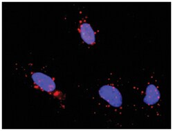 anti-TP53, CREB1 Protein Protein Interaction Antibody Pair, Abnova™