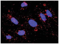 Abnova Corporation&nbsp;anti-EGFR, STAT3 Protein Protein Interaction Antibody Pair, Abnova&trade;