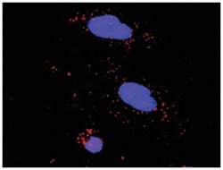 anti-TP53, PPP2R5C Protein Protein Interaction Antibody Pair, Abnova™