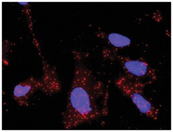 anti-MMP2, TGFB1 Protein Protein Interaction Antibody Pair, Abnova™