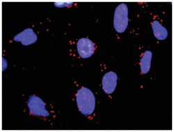anti-MAP3K7, RELA Protein Protein Interaction Antibody Pair, Abnova™