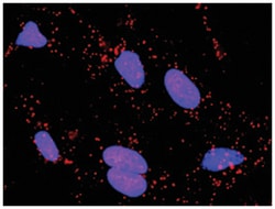 anti-FAS, RAP1A Protein Protein Interaction Antibody Pair, Abnova™