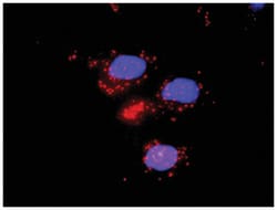 anti-IL6, ZBTB16 Protein Protein Interaction Antibody Pair, Abnova™