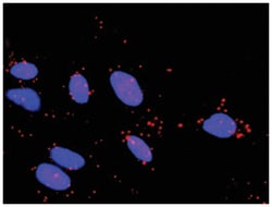 anti-MAP2K3, TAOK2 Protein Protein Interaction Antibody Pair, Abnova™