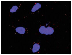 anti-FGF5, MAPK1 Protein Protein Interaction Antibody Pair, Abnova™