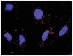 anti-BIRC3, IKBKB Protein Protein Interaction Antibody Pair, Abnova™