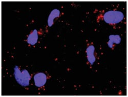 anti-DVL1, CSNK2A1 Protein Protein Interaction Antibody Pair, Abnova™