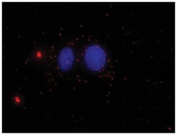 Abnova Corporation&nbsp;anti-SUFU, GLI1, Human, Protein Protein Interaction Antibody Pair, Abnova&trade;
