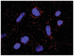 Abnova Corporation&nbsp;anti-RPS6KB1(Phospho S418), RPS6KB1 Protein Protein Interaction Antibody Pair, Abnova&trade;