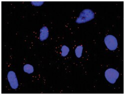 anti-ATF2(Phospho S322), ATF2 Protein Protein Interaction Antibody Pair,
