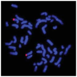 Abnova 10q Subtelomere (Texas Red) FISH Probe 20 &mu;L | Buy Online | Abnova&trade; | Fisher Scientific