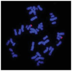Abnova 11q Subtelomere (Texas Red) FISH Probe 20 &mu;L | Buy Online | Abnova&trade; | Fisher Scientific