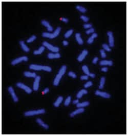 Abnova 19p Subtelomere (Texas Red) FISH Probe 20 &mu;L | Buy Online | Abnova&trade; | Fisher Scientific